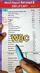 133K views · 2.2K reactions | CBC blood test Report||part-7|| #labtechnician #health #healthcare #CBCReport | Rayyan Alam | Facebook