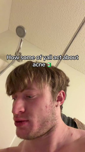 Acne Reactions & Solutions: What's Your Skin Type?