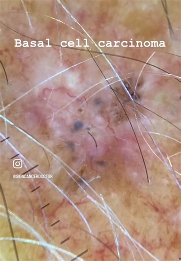 skincancerdoctor on TikTok