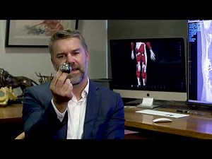 Hip Resurfacing Surgery Explained by Orthopaedic Surgeon Dr Dan Fick