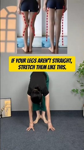 Straighten Bow Legs & Tone Flabby Arms Fast (DO THIS DAILY!)