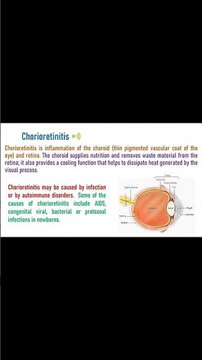 Chorioretinitis - Inflammation of Choroid and Retina