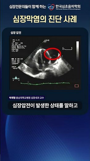 심막염의 진단사례