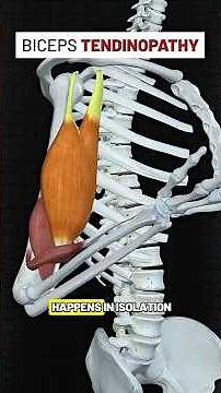 Biceps Tendinopathy Rehab Exercises