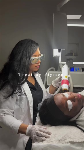 Transforming Hyperpigmentation with Aerolase Laser