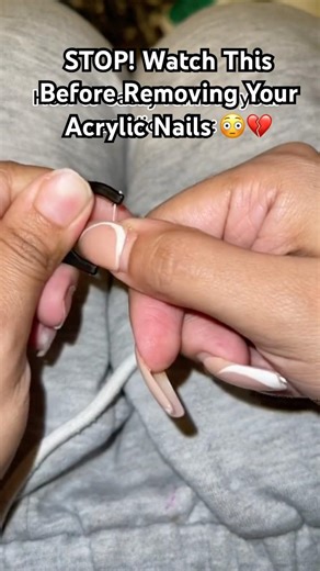 STOP! Watch This Before Removing Your Acrylic Nails 😳💔