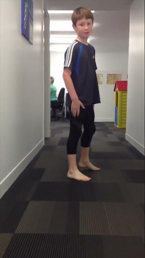 Pigeon Toe Gait Correction with Spiral Thigh Brace - 061 - Part 2 of 2