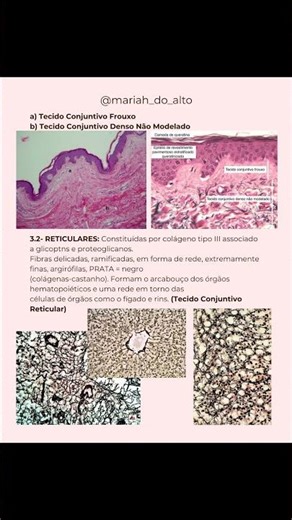 📚Tecido conjuntivo🩷 #histologia #estudantedemedicina #medicina #resumo #estudos