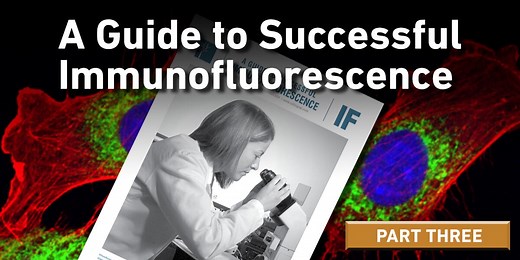 Successful Immunofluorescence: Fixation & Permeabilization | CST Blog