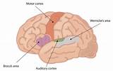 Images of What Part Of The Brain Controls Speech And Motor Skills
