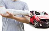 Auto Injuries