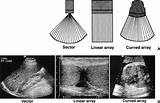 How Long Is Medical Sonography School Pictures