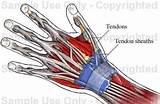 Wrist Tendon Injury Recovery Time