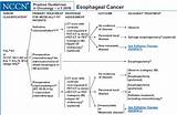 Chemotherapy And Radiation Therapy For Esophageal Cancer Images