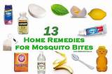 Scorpion Stings Home Remedies Images
