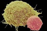 Car T Cell Side Effects Images