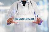 Images of What Will A Doctor Do For Hemorrhoids