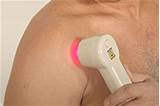 Pictures of Near Infrared Laser Therapy