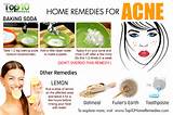 Acne Clearing Home Remedies Images