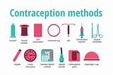 Ne Planon Birth Control Implant Side Effects