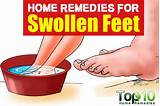 Photos of Home Remedies Web