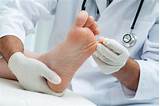 Which Doctor To Consult For Swelling In Feet Pictures