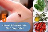 Effective Home Remedies For Bed Bugs Images