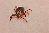 Wood Tick Pictures