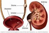 What Does A Renal Doctor Do Pictures