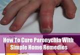 Paronychia Toe Home Remedies Photos