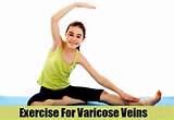 Pictures of Exercises Varicose Veins