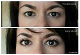 Pictures of How To Apply Eye Makeup To Hooded Lids