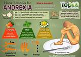 What Are Some Treatments For Anorexia Pictures