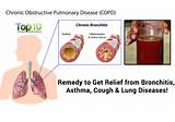Photos of Home Remedies Pneumonia Bronchitis