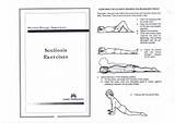 Exercises Scoliosis Photos