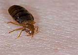 Kill Bed Bugs Yourself Alcohol