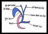 What Is A Ercp Medical Procedure Pictures