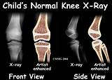 Photos of A Knee Doctor Is Called