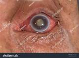 Eye Doctor Close To Me Pictures