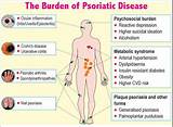 Psoriatic Arthritis Doctor