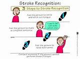 Major Stroke Recovery Pictures