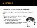 Acquired Brain Injury Treatment Photos