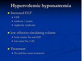 Treatment Of Hyponatremia In Chf Pictures