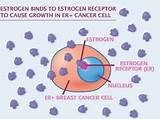 Pictures of Estrogen Receptor Breast Cancer Treatment