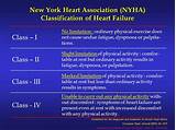 Nyha Heart Failure Classes Pictures