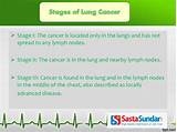 Advanced Lung Disease Symptoms Images