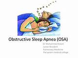 Severe Obstructive Sleep Apnea Treatment Images
