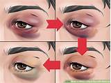 How To Create A Black Eye With Makeup Images