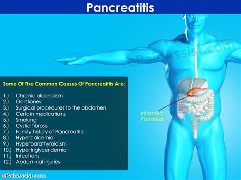 Can Pancreatitis Cause Liver Damage