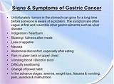 Gastric Problem Symptoms Treatment Pictures